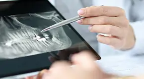 Dentist holding a stylus and pointing to dental X-rays on a tablet