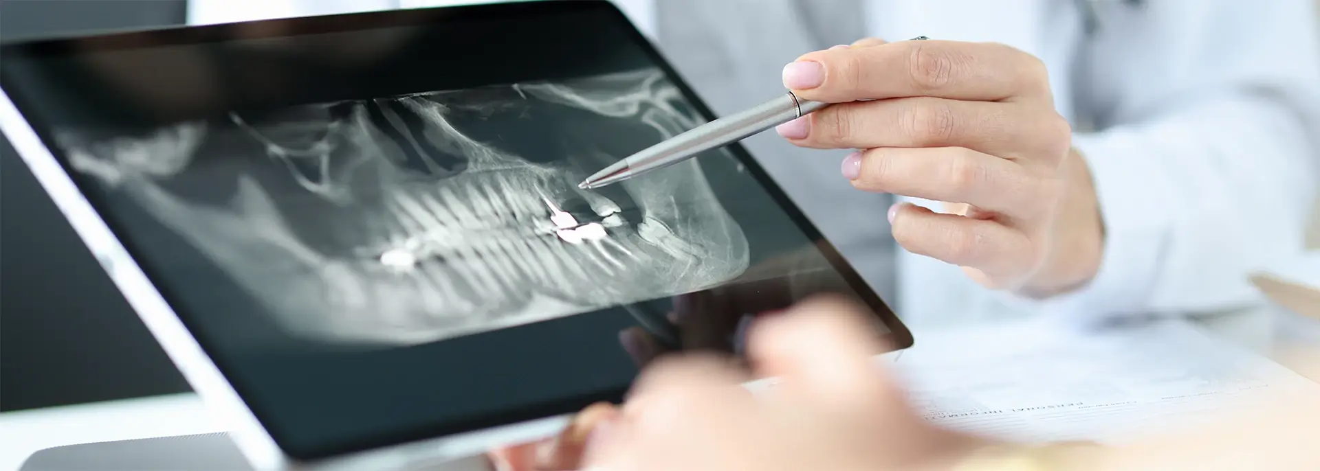 Dentist holding a stylus and pointing to dental X-rays on a tablet